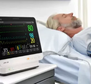 Patient Monitor